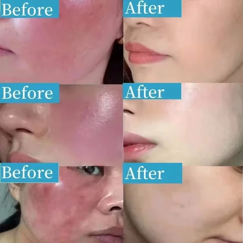 Korean Facial Redness Repair C - Coenzyme Q10 Cream 评论和价格