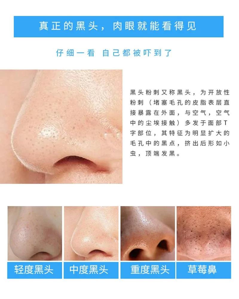 30 Pcs Bamboo Charcoal Nose St - Charcoal Pore Strip 评论和价格