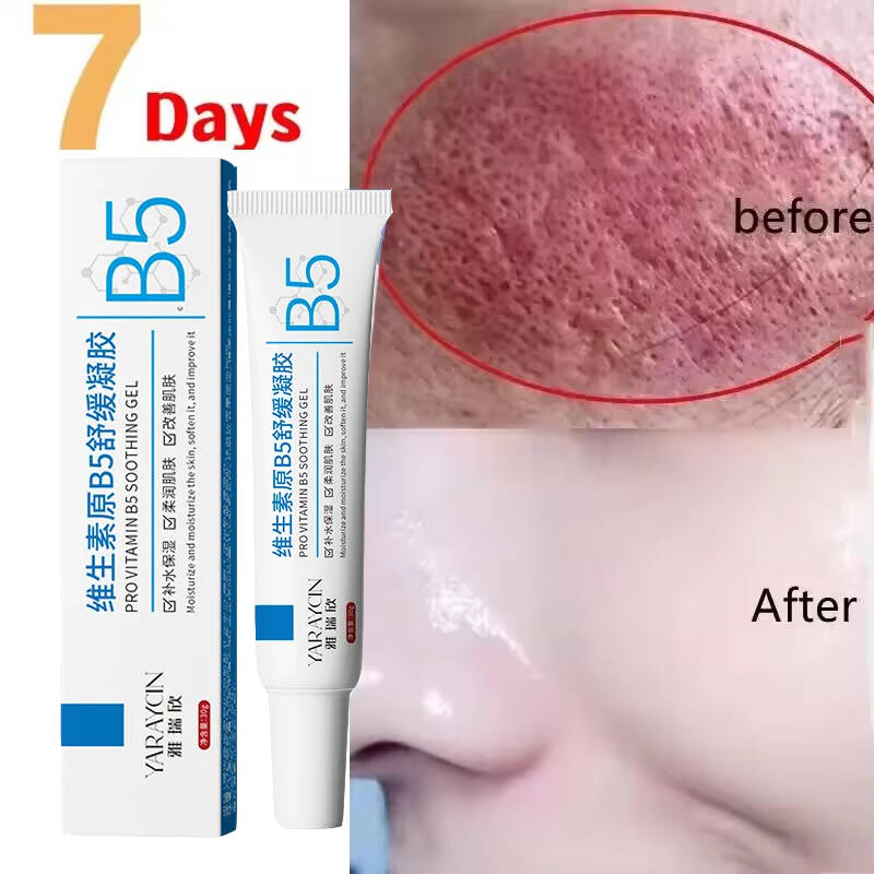 Facial Redness Repair Cream Im - Coenzyme Q10 Cream 评论和价格